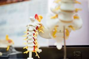 Know Herniated Discs Know Herniated Discs